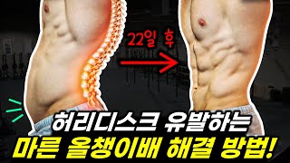 팔 다리는 가는데 유독 배만 볼록 튀어나온 사람은 '이 습관' 때문입니다! (올챙이배 해결 방법)