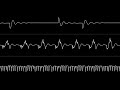 jammer “drummage” c64 oscilloscope view