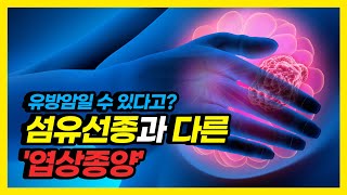 유방에서 빠른 속도로 자라는 엽상종양! 치료법은?