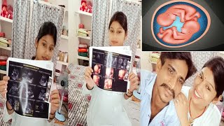 प्रेगनेंसी में आया नया ट्विस्ट 😱🤫 क्या सच में हमारी twins प्रेगनेंसी है?#vlog #pregnancy #reveal