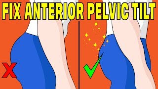 How to fix anterior pelvic tilt without any equipment - The Natural Method