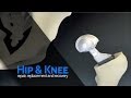 What is a Hip Replacement: Rapid Recovery Hip Replacement