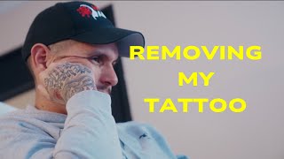 Removing My Tattoo