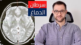 سرطان المخ | الأعراض والعلاج