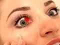 MANGLED EYE!!!!!!! MANGLED EYE!!!!!!!