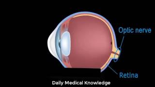 Eye Anatomy and Common Defects Animated Tutorial