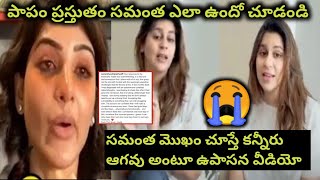 సమంత మొహం చూస్తే కన్నీరు ఆగవు అంటూ ఉపాసన / latest shoking news goes viral/