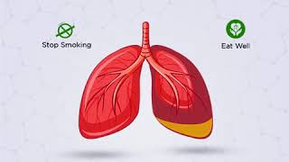 Interstitial Lung Disease (ILD) and how to deal with Interstitial Lung Disease (ILD)