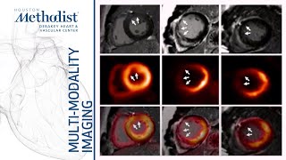 Heart Failure I: Evaluating Myocardial Viability (Zoghbi MD; Al-Mallah MD; Shah MD) January 5, 2021