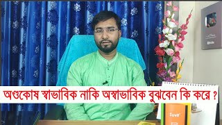 অণ্ডকোষে কি কি রোগ হতে পারে এবং তার লক্ষণ গুলো কি কি জেনে নিন !! Dr Hakim Foridujjaman