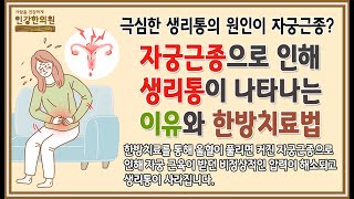 자궁근종으로 극심한 생리통이 생기는 원인을 알고 한방치료로 혈울(血鬱)을 제거하면 통증에서 해방될 수 있습니다!