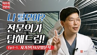 급성기 탈모, 갑자기 머리가 많이 빠지는 이유! 피부과에서 가능한 탈모치료