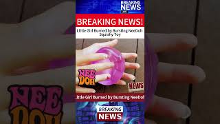 Little Girl Burned by Bursting NeeDoh Squishy Toy#foryou #fyp #fypage #fypシ゚viral #foryoupage