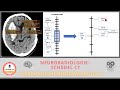 CT Schädel: die richtige Fenster-Technik bei der Bildanalyse