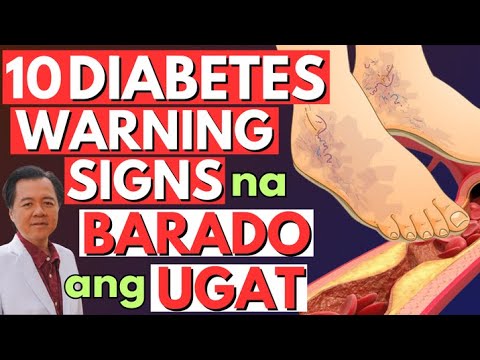 10 Diabetes Warning Signs Na Barado Ang Ugat By Doc Willie Ong