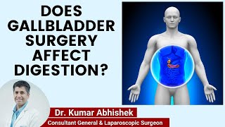 Does Removing Gallbladder affect Digestion? | Life After Gall Bladder Removal | Healing Hospital