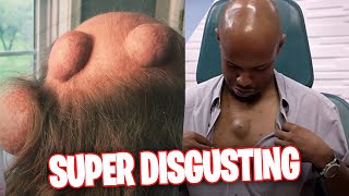 The Most DISGUSTING MOMENTS on Dr. Pimple Popper that made us SHUDDER!