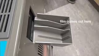 DATV- Developing Dental XRays