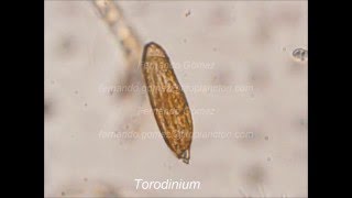 dinoflagellate Torodinium