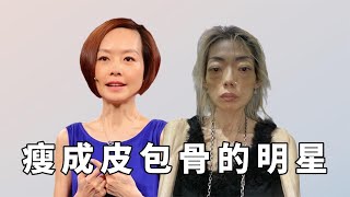 瘦到脱相的七位女星，鲁豫脸颊凹陷皮包骨，张曼玉青蛇变白骨精