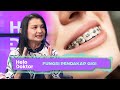 Fungsi Pendakap Gigi | Helo Doktor (13 Aug 2023)