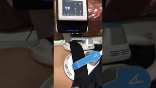 Emsculpt Portable | HIFEM Technology | Test Video #aesthetics #hifutreatment #ems