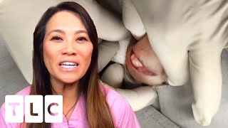 “Break Them Free”: Dr Lee Removes A Stubborn Lipoma | Dr. Pimple Popper: This Is Zit