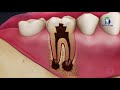 பல் வலி மருத்துவரின் ஆலோசனை dr.karthikeyan explains about causes of tooth pain and how to prevent it