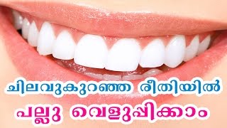 ചെലവുകുറഞ്ഞ രീതിയില്‍ പല്ലു വെളുപ്പിക്കാം | Teeth Whitening Tip