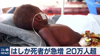 新型コロナ感染拡大の裏で…「はしか」による死者が急増　世界で20万人超（2020年11月13日）