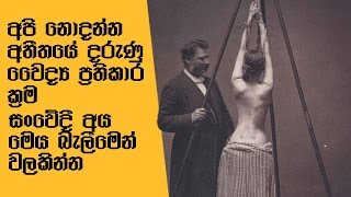 අපි නොදන්න අතීතයේ දරුණු වෛද්‍ය ප්‍රතිකාර ක්‍රම - Old Medical Treatments