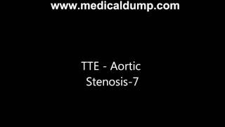 Aortic Valve Stenosis - Transthoracic Echocardiogram (TTE)