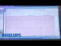 EMS Today 2013 Product Video: Philips