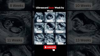 Fetal Ultrasound Scan Week by Week 😍 8 to 18 Weeks Fetal Development #pregnancy #fetus #share