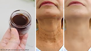 Anti aging magic oil, ☘️ This oil will erase all the wrinkles on your face, stronger than Botox