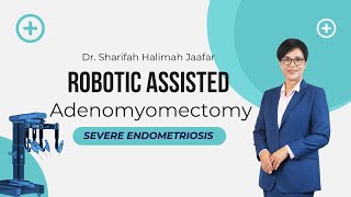 HOW ROBOTIC SURGERY WORKS : ADENOMYOMECTOMY FOR SEVERE ENDOMETRIOSIS | DR Sharifah Halimah