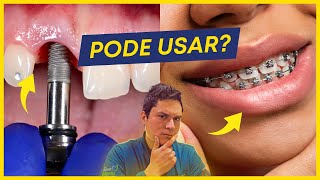 Quem tem IMPLANTE pode colocar APARELHO nos DENTES?