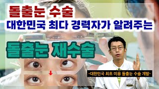 If you're thinking about re-surgery for protruding eyes, make sure to watch it!