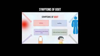 Symptoms of gout #uricacid #gout #uricacidsymptoms #goutsymptoms