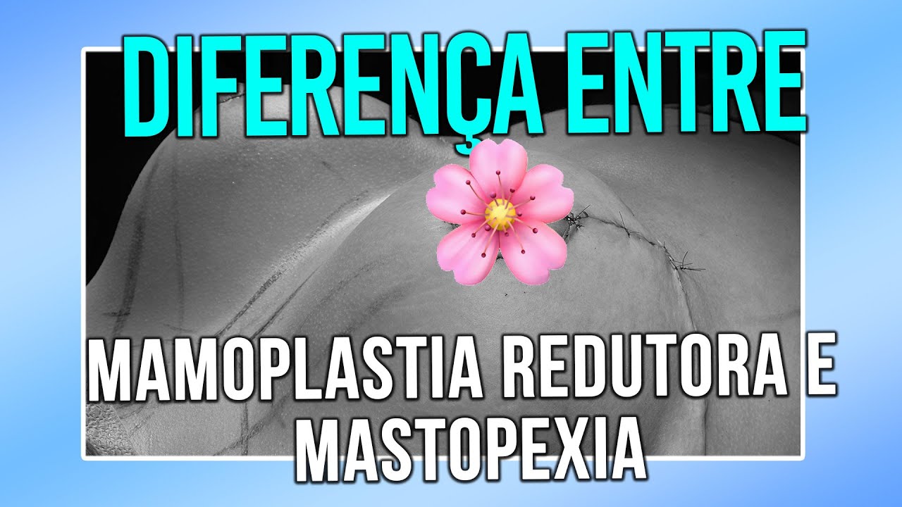 DIFERENÇA ENTRE MAMOPLASTIA REDUTORA E MASTOPEXIA - CIRURGIA PLÁSTICA ...