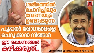 ശരീരത്തിൽ ചൊറിച്ചിലും വേദനയും ഉണ്ടാകുന്ന ഫംഗസ് രോഗങ്ങൾ മാറാൻ ഈ ഭക്ഷണങ്ങൾ ഒഴിവാക്കണം.