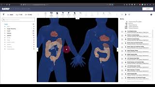 EUI 1.7.0 Demo