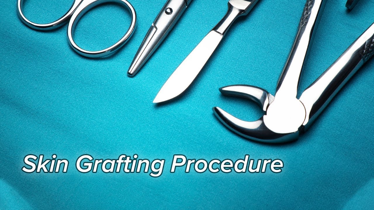 Skin Grafting Procedure - YouTube