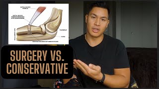 Why I Chose Surgery over non-Surgery 2023 (Distal Bicep Tendon Rupture)
