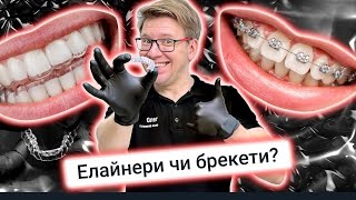 Вирівняти зуби: обираємо між брекетами та елайнерами 🦷👨‍🔬 #DrNychyporchuk_clinic #smile #toothcare