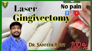 Laser Gingivectomy || by Dr.Sanjeeb Rout || balaji superspecialty clinic