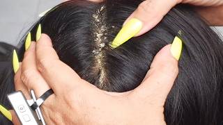ASMR Deep Sleep 😴 Ultimate Calm Scalp Care & Slow Hair Cleaning Sounds VF000292