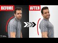 Fix Your Rounded Shoulders! 6 Simple Stretches To Correct Posture