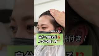 女性必見！自分で出来るハゲの隠し方