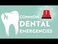 Common Dental Emergencies